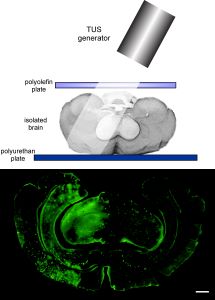 UNA PROTESI CRANICA IMPIANTABILE PERMETTE IL PASSAGGIO DEGLI ULTRASUONI PER L’IMAGING E LA TERAPIA CEREBRALE: LA DIMOSTRAZIONE AL BESTA